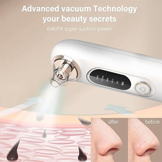 Zentheca – PureLift Pore Extractor showcasing advanced vacuum technology and super suction power for clear skin.