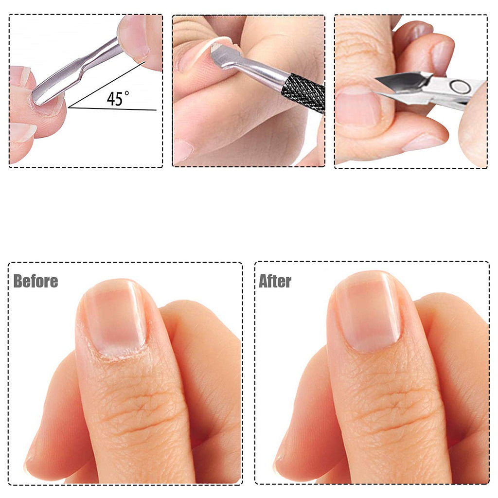 Zentheca – Dual-Ended Cuticle Pusher & Trimmer showcasing before and after nail care results.