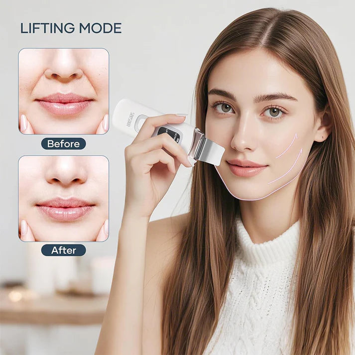 Zentheca – Ultrasonic Facial Scrubber demonstration showing before and after results in lifting mode.